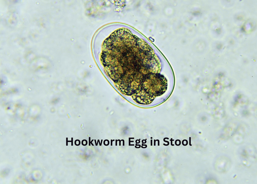 microscopic view of a hookworm egg in stool