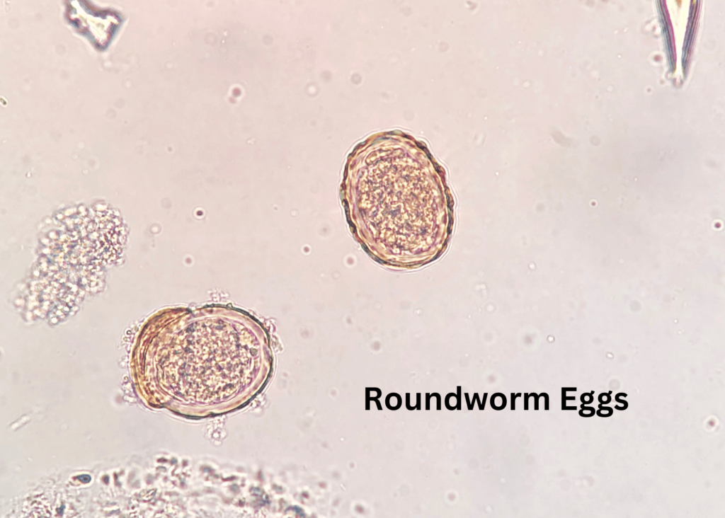 microscopic view of roundworm eggs